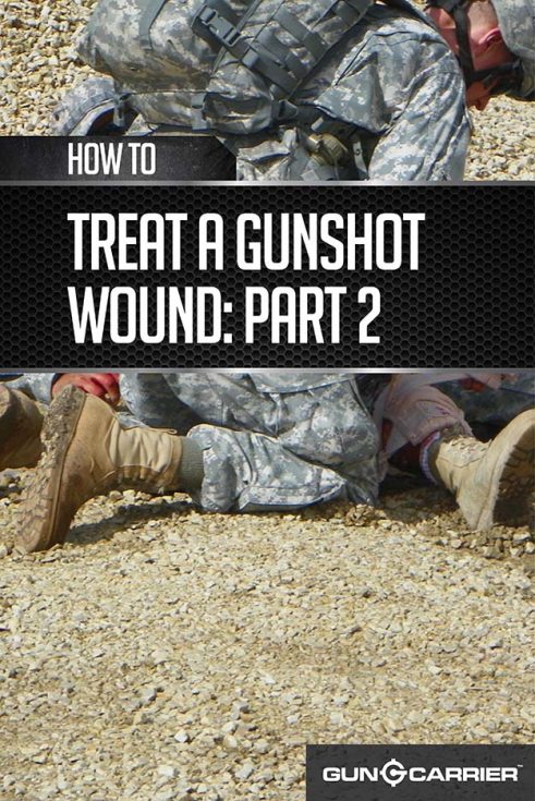 New Treatment Can Plug Gunshot Wounds In Seconds May Save Lives On The