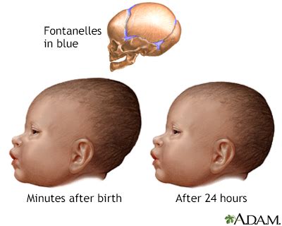 Newborn Moulding Guide: Healthy Development