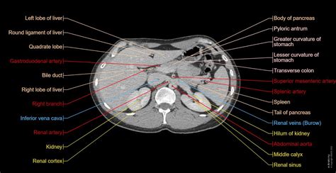 Normal Ct Scan Abdomen Pelvis