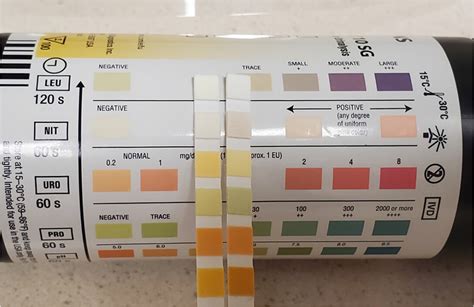 Office Based Urinalysis A Comprehensive Review 2024