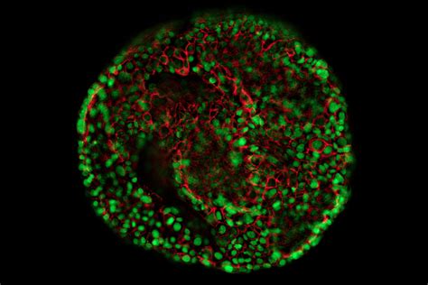 Organoids And 3D Cell Culture Applications Leica Microsystems