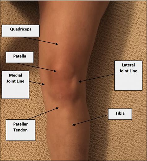 Pain On Outer Side Of Knee Ebikeai