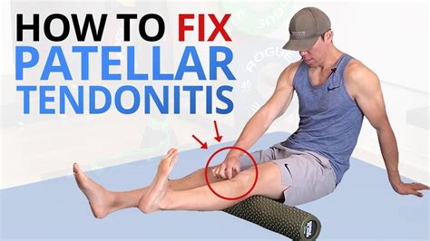 Patellar Tendonitis Relief: Stretching Solutions