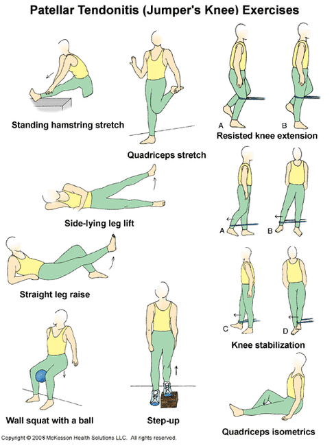 Patellar Tendonitis Stretching