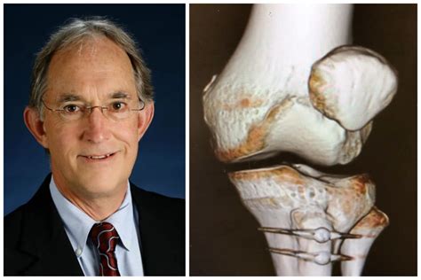 Patellofemoral Research Program Launches For Yale Orthopaedics