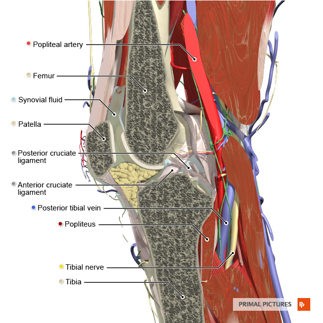 Patellofemoral Syndrome: Relieve Knee Pain