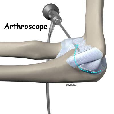 Patient Education Concord Orthopaedics