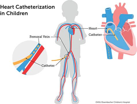 Pediatric Heart Care Diagnostic Tests Doernbecher Children S