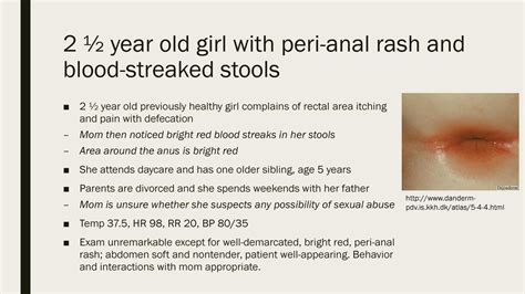 Perianal Strep Infection