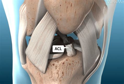 Pin On Acl Injury