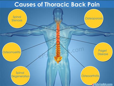 Pin On Back Pain Relief Lower Mid Upper Back Pain