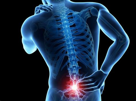 Pin On Back Pain