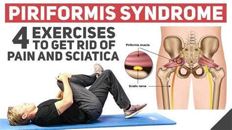 Piriformis Exercises: Relieve Pain Quickly