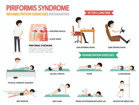 Piriformis Syndrome Exercises: Relief Guaranteed