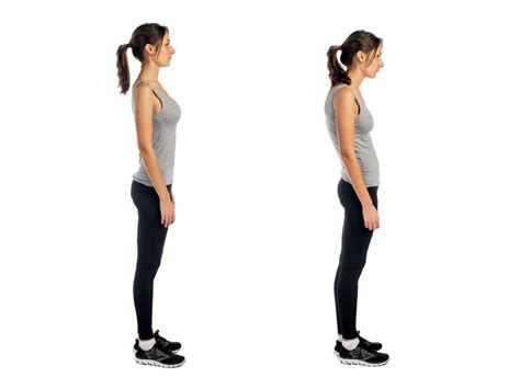 Poor Posture Fight Muscle Imbalance Https Karprehab Com