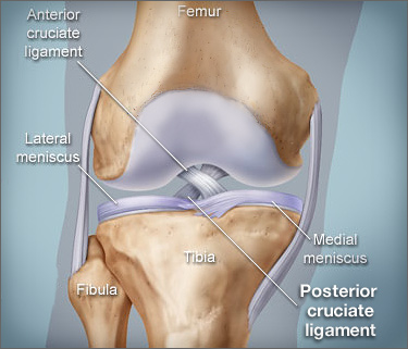 Posterior Cruciate Ligament Pcl Injury Sports Medicine