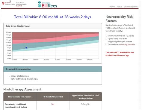 Premie Bili Recs: Find Top Rated Options