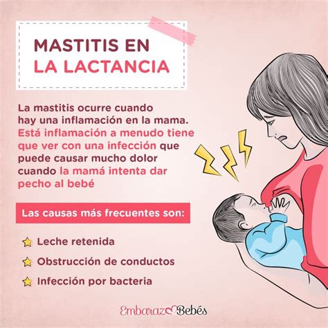 Prevent Mastitis Lactancia Materna Lactancia Y Parter A