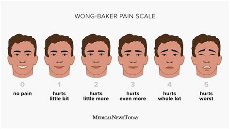 Printable Wong Baker Pain Scale