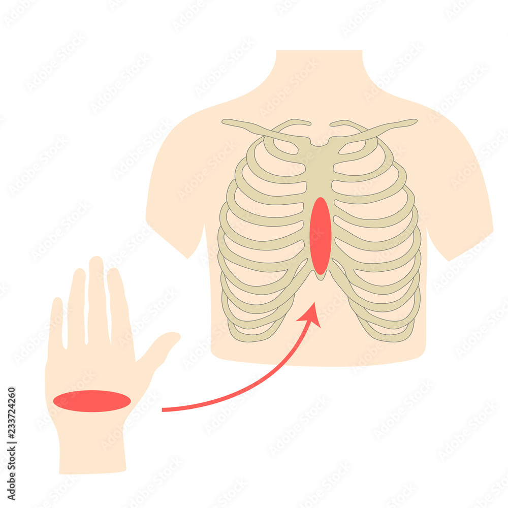 Proper Cpr Technique: Master Hand Position