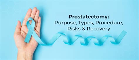 Prostatectomy Purpose Types Procedure Risk And Recovery