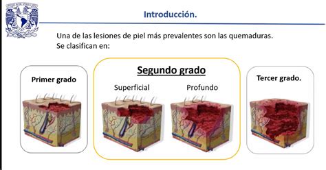 Quemaduras De Segundo Grado: Tratamiento Completo