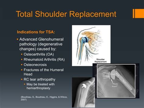 Reverse Total Shoulder Replacement Anatomy Rehabilitation And Clin