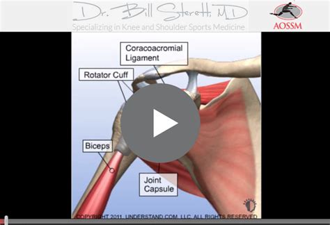 Rotator Cuff Surgery Q A The Knee Doctor