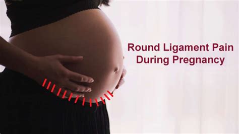 Round Ligament Pain During Pregnancy Causes And Treatment