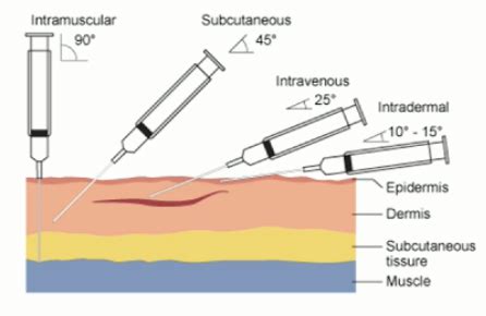 Routes Of Administration Parenteral Flashcards Quizlet