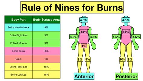 Rule Of 9 Burn Chart Printable