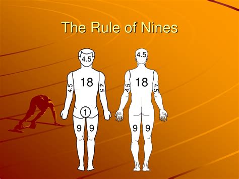 Rule Of Nines Quiz