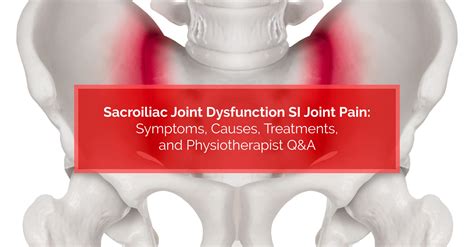 Sacroiliac Joint Pain Symptoms Causes And Treatment