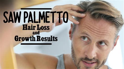 Saw Palmetto Hair Loss Results Does It Help Grow Hair Youtube