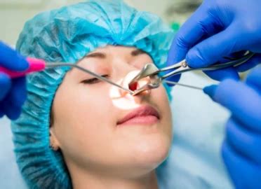 Septoplasty Recovery Time: Fast Healing Tips