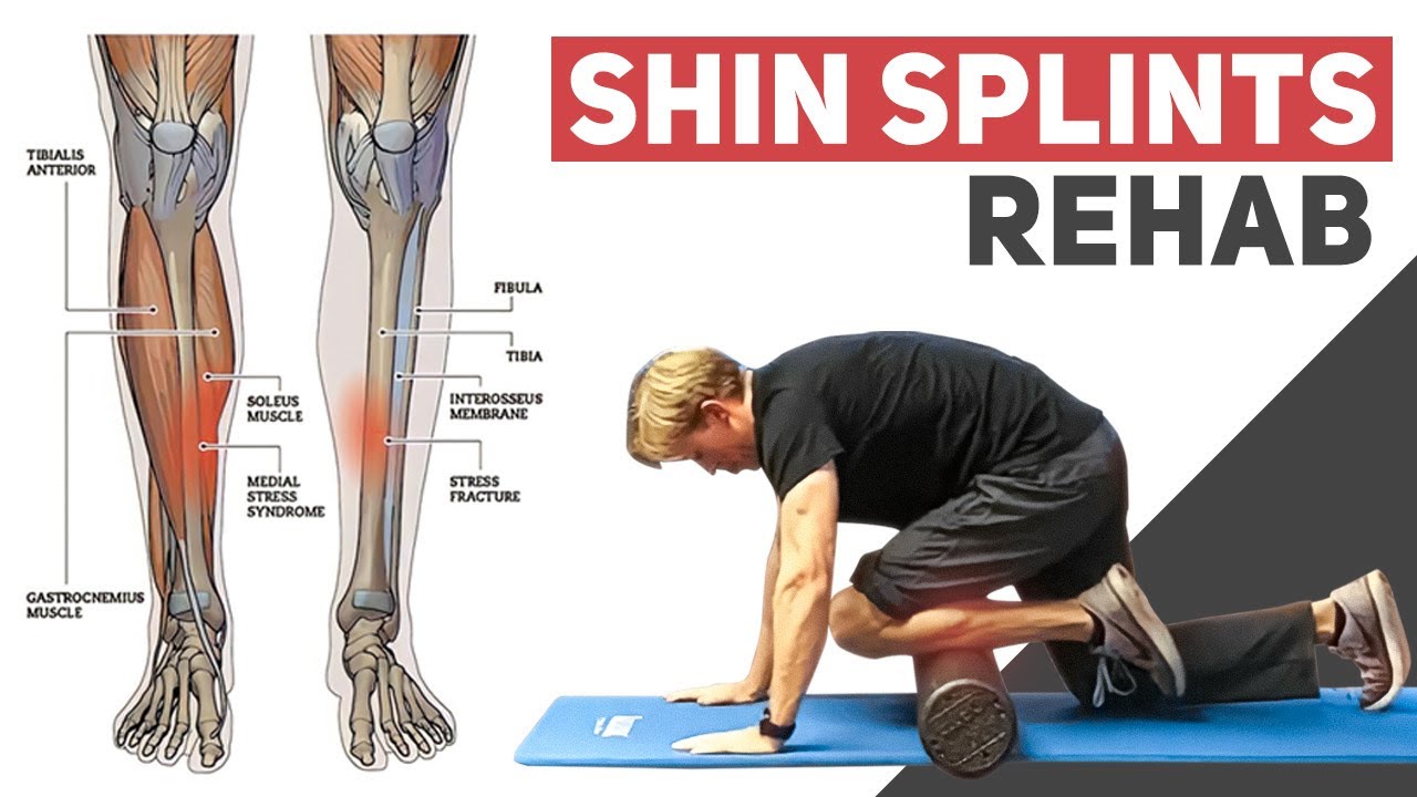 Shin Splints Explained: Medial Tibial Stress Syndrome, 52% Off