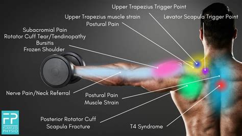 Shoulder Pain Diagnosis Diagram