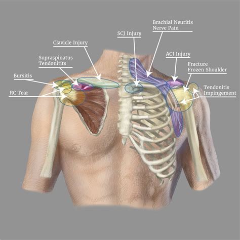 Shoulder Pain Symptom Checker Pain Diagnosis Chart Injury Self