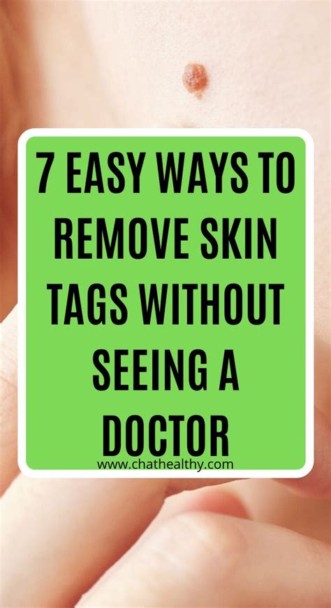 Skin Tag Removal Guide: Easy At Home