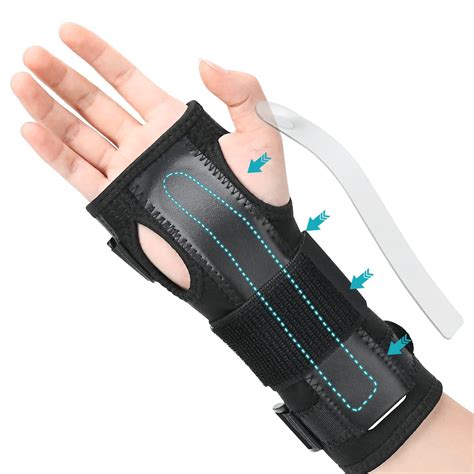 Splinting A Wrist