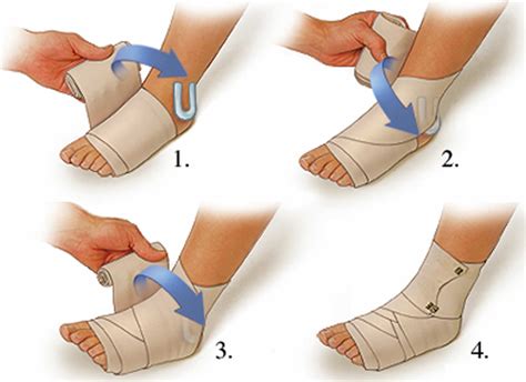 Sprained Ankle Wrap Guide