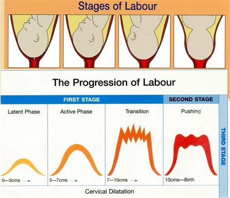 Stages Of Labor Diagram