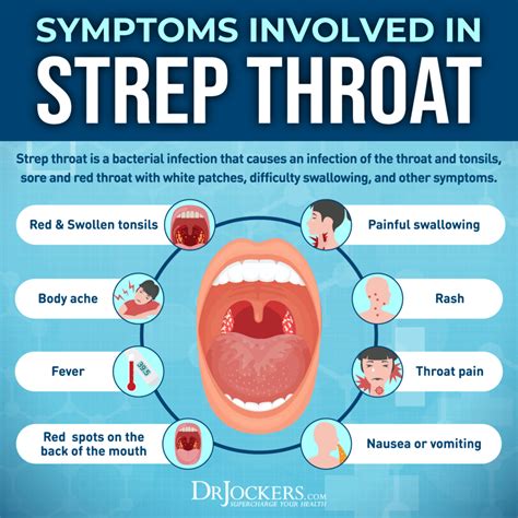 Strep Throat 10 Strep Throat Symptoms