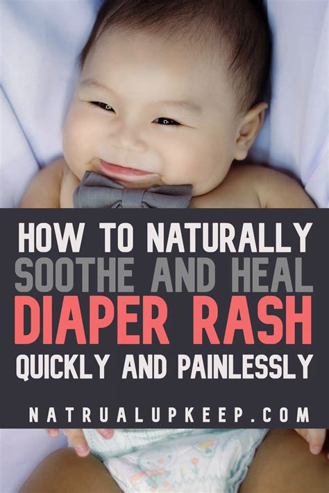 Streptococcal Nappy Rash: Effective Home Remedies