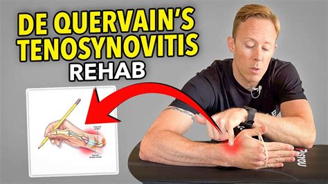 Summit Medical Group De Quervain S Tenosynovitis Exercises Hot Sex