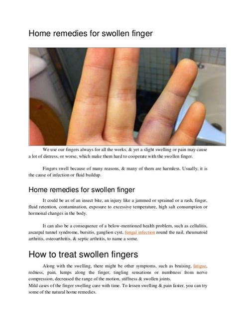 Swollen Finger Bruise Relief: Fast Healing