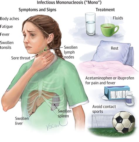 Symptoms Of Mono In Children Cbc Parents