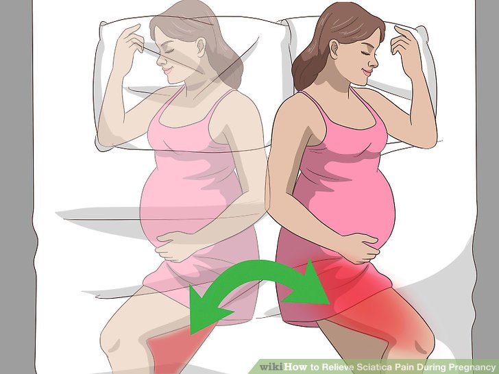 Terry F How To Relieve Sciatica Hip Pain During Pregnancy