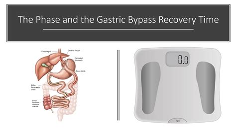 The Phase And The Gastric Bypass Recovery Time Youtube