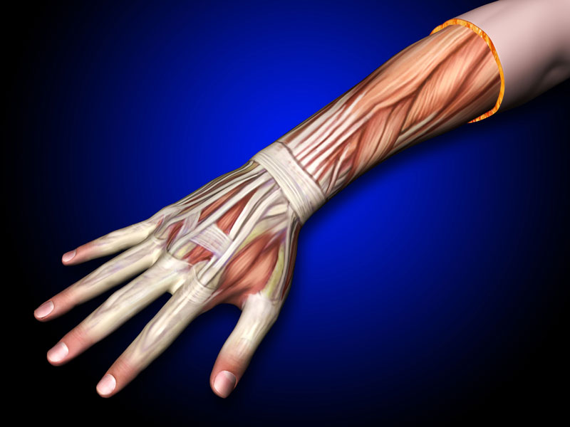 Therapy For Wrist Tendonitis